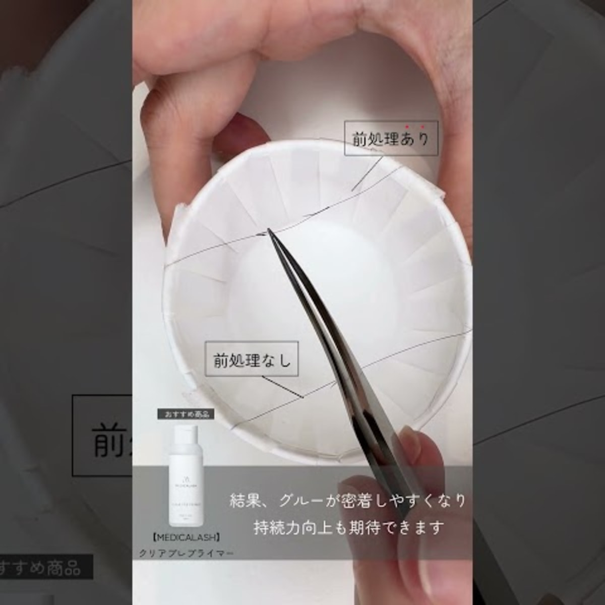 MEDICALASH】国産PMMAフリーグルー＜ゼロ＞ 5gの通販・卸売り | アイ 