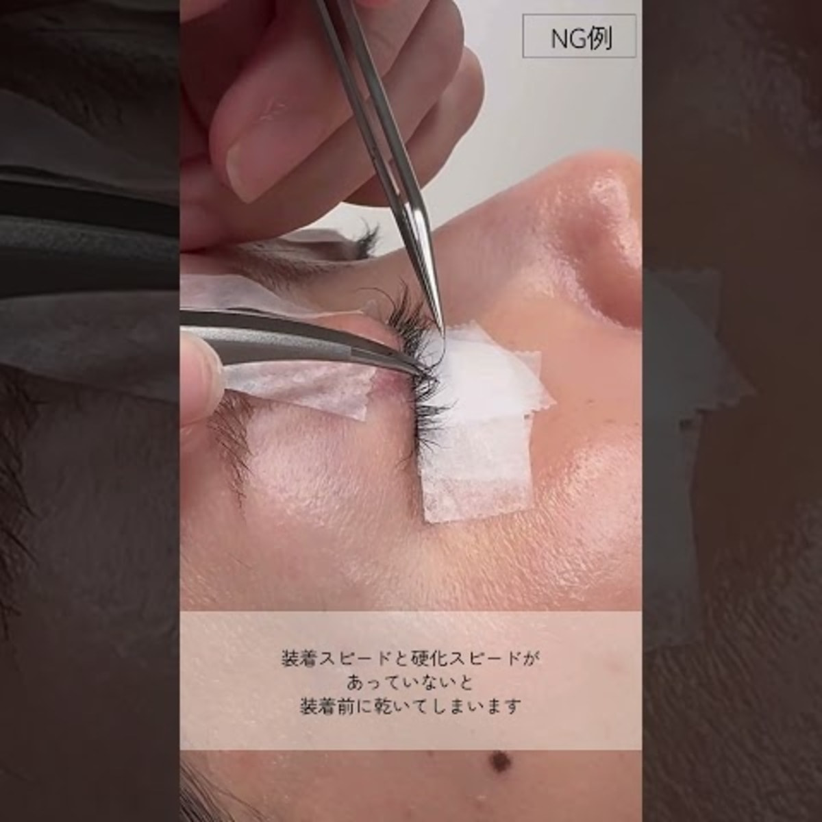 MEDICALASH】国産PMMAフリーグルー＜ゼロ＞ 5gの通販・卸売り | アイ 